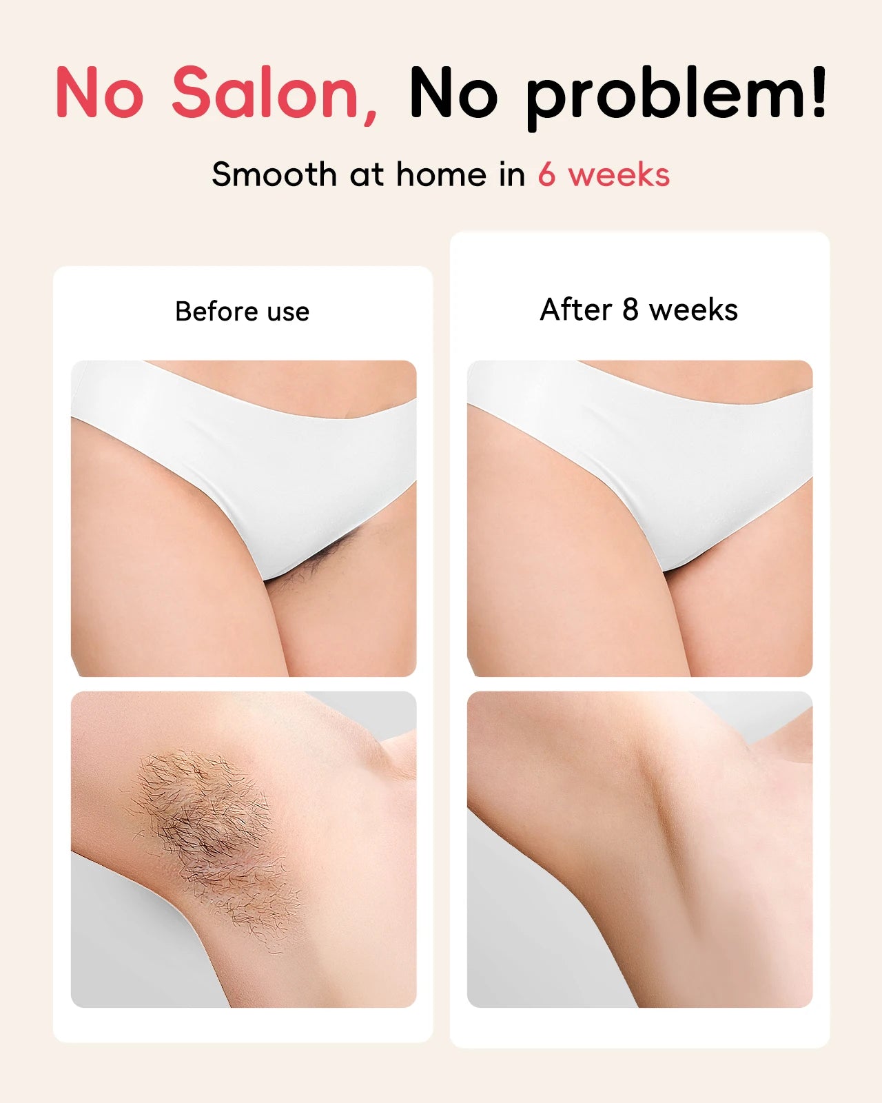 IPL Hair Removal Laser Unlimted light pulses 22J Painless Ultra-fast Light Emission hair removal for men women All Body Treament